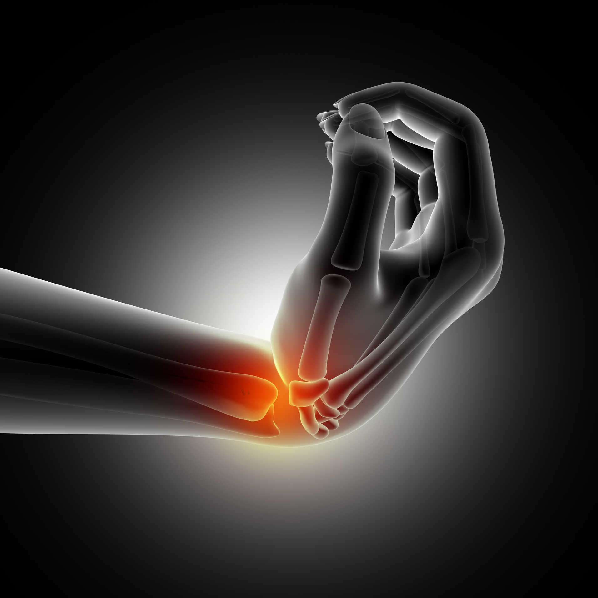 Hand Pain Treatments More